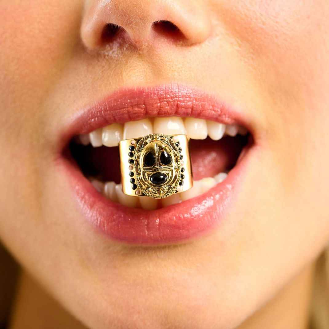 Gold dental implant with black gemstones in a person's mouth