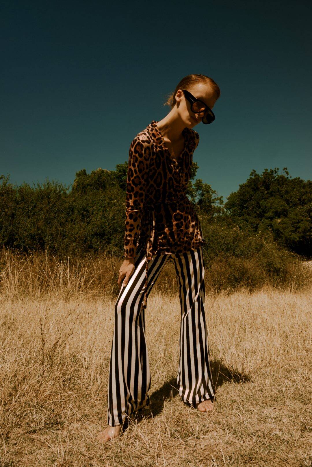 Person wearing a leopard print top and black and white striped pants standing in a field with trees in the background.